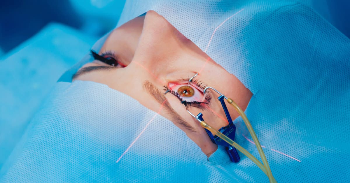 Cirurgia Refrativa